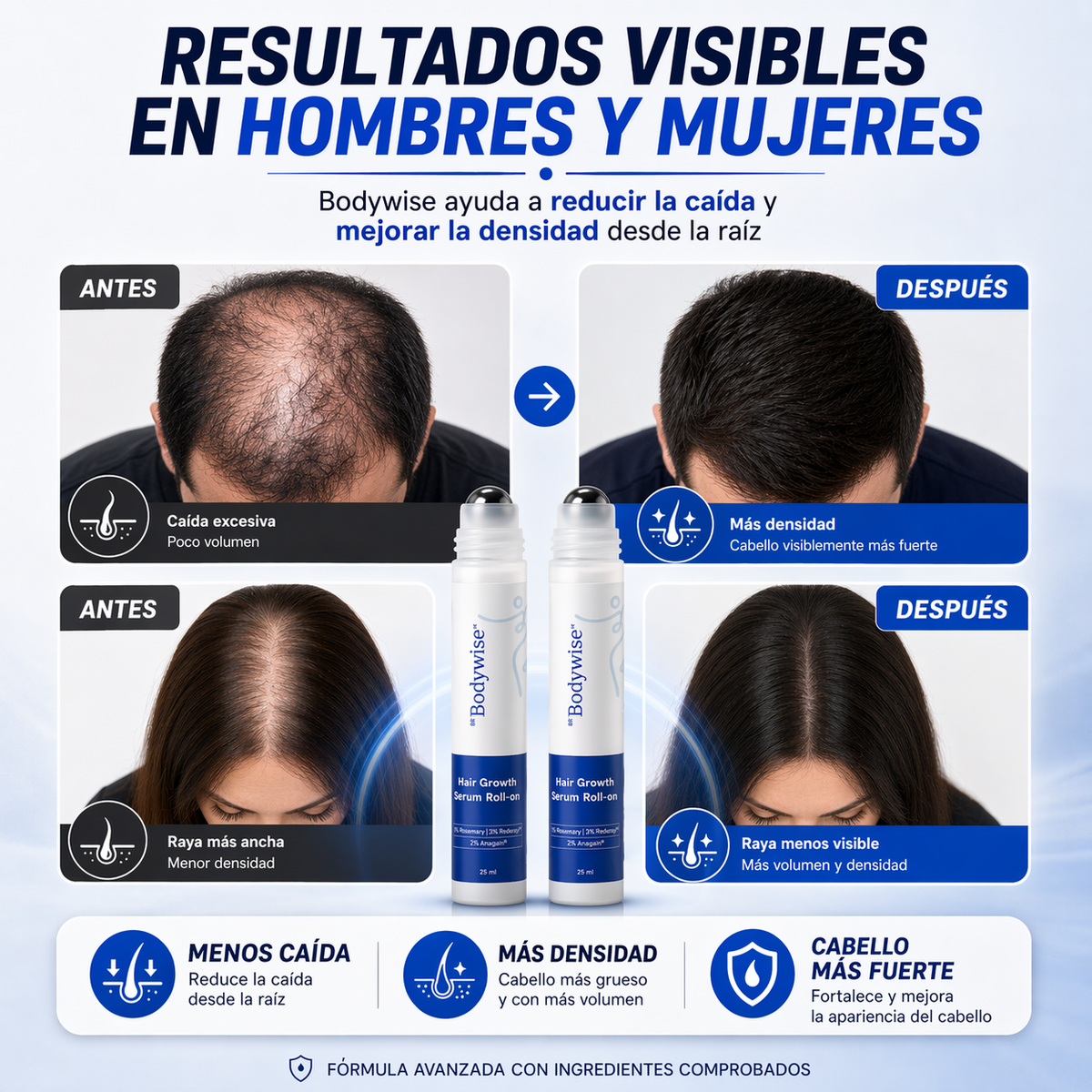 Bodywise Roll-On Capilar Anticaída
