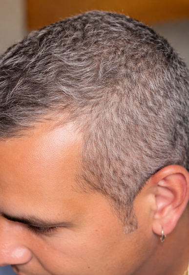 Antes